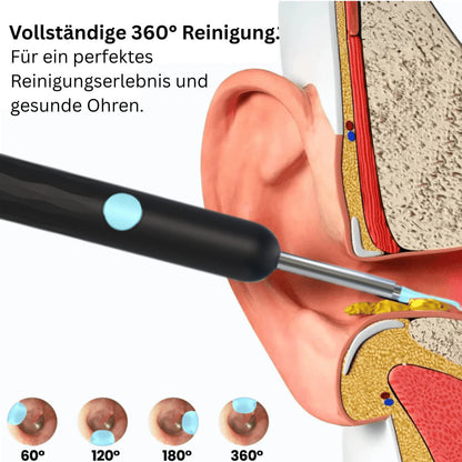 Earify™ | Professionele oor reiniging